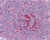 IHC testing of FFPE human spleen tissue with GABPB2 antibody at 3.75ug/ml. Required HIER: steamed antigen retrieval with pH6 citrate buffer; AP-staining.