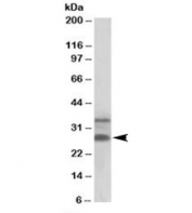 Western blot testing of human skin lysate with C16orf57 antibody at 0.3ug/ml. Predicted molecular weight: ~30/21kDa (isoforms 1/3).