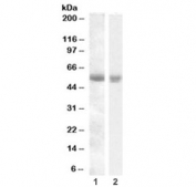 Western blot testing of human 1) pancreas and 2) kidney lysate with TMPRSS2 antibody at 0.1ug/ml. Predicted molecular weight: ~54 kDa.
