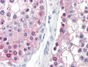 IHC testing of FFPE human testis tissue with DYDC1 antibody at 5ug/ml. Required HIER: steamed antigen retrieval with pH6 citrate buffer; AP-staining.