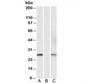 Western blot of HEK293 lysate overexpressing human DYDC1-MYC lysate (Lane A) and mock-transfected lysate (Lane B) with DYDC1 antibody at 1ug/ml. Lane C - same transfected lysate tested with anti-MYC tag (1:1000). Predicted molecular weight: ~21/22 kDa (isoforms 1/2).