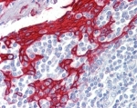 IHC staining of FFPE human tonsil with Cytokeratin 13 antibody at 2.5ug/ml. HIER: steamed with pH6 citrate buffer, AP-staining.