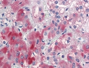 IHC testing of FFPE human adrenal gland tissue with ENC1 antibody at 5ug/ml. Required HIER: steamed antigen retrieval with pH6 citrate buffer; AP-staining.