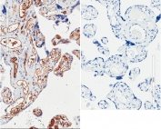 IHC staining of FFPE human placenta tissue with (left) and without (right) PIK3C2A antibody at 2ug/ml. Required HIER: steamed antigen retrieval with pH6 citrate buffer; HRP-staining.