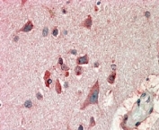 IHC staining of FFPE human cerebral cortex with FBXL2 antibody at 10ug/ml. HIER: steamed with pH6 citrate buffer, AP-staining.