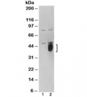 Western blot of HEK293 lysate overexpressing TFPI and probed with TFPI antibody (mock transfection in lane 1). Predicted/observed molecular weight: 35/40-50kDa.