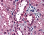 IHC staining of FFPE human kidney tissue with P2RX7 antibody at 3.75ug/ml. HIER: steamed with pH6 citrate buffer, AP-staining.