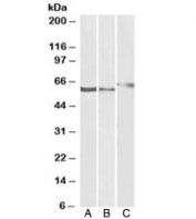 Western blot testing of human A) kidney, B) liver and rat C) kidney lysate with P2RX4 antibody at 1ug/ml. Expected molecular weight: 43-70 kDa depending on glycosylation level.
