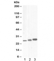 Western blot testing of 1) mouse, 2) rat and 3) pig testis lysate with Casein kinase 2 beta antibody at 0.3ug/ml. Predicted molecular weight: ~25kDa.