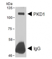 2ug of PKD1 antibody was used to immunoprecipitate PDK1 from transfected HEK293 cells which was then western blot tested with the same PKD1 antibody at 1ug/ml. Expected molecular weight ~102 kDa. Data courtesy of Dr Peter Storz, Mayo Clinic, USA.