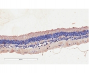 IHC testing of FFPE human retinal with CNGB3 antibody at 2ug/ml. Staining of the pigmented epithelial cells is seen.