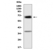 Western blot testing of rat RH35 cell lysate with Alpha 1 Fetoprotein antibody at 0.5ug/ml. Predicted molecular weight ~67 kDa.