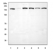 Western blot testing of human 1) RT4, 2) HaCaT, 3) HepG2, 4) SiHa, 5) K562 and 6) MCF7 cell lysate with EEA1 antibody at 0.5ug/ml. Predicted molecular weight ~162 kDa.