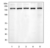 Western blot testing of 1) rat brain, 2) rat lung, 3) mouse brain, 4) mouse kidney and 5) mouse lung tissue lysate with EEA1 antibody at 0.5ug/ml. Predicted molecular weight ~162 kDa.