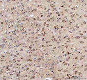 IHC staining of FFPE rat brain tissue with EEA1 antibody. HIER: boil tissue sections in pH8 EDTA for 20 min and allow to cool before testing.