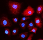 Immunofluorescent staining of FFPE human A549 cells with EEA1 antibody (red) and DAPI nuclear stain (blue). HIER: steam section in pH6 citrate buffer for 20 min.
