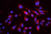IF/ICC staining of FFPE human U-2 OS cells with cIAP1 antibody (red) at 2ug/ml and DAPI nuclear stain (blue). HIER: steam section in pH6 citrate buffer for 20 min.