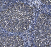 IHC testing of FFPE human tonsil tissue with CD80 antibody. Required HIER: steam section in pH8 EDTA buffer for 20 min and allow to cool prior to staining.