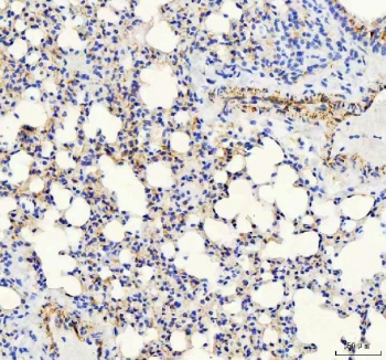 IHC staining of FFPE rat lung tissue with VE Cadherin antibody. HIER: boil tissue sections in pH8 EDTA for 20 min and allow to cool before testing.