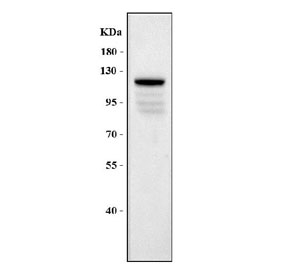 Western blot testing of mouse lung tissue lysate with VE Cadherin antibody at 0.5ug/ml. Expected molecular weight: 90~140 kDa depending on glycosylation level.