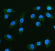 Immunofluorescent staining of FFPE human A549 cells with FABP5 antibody (green) and DAPI nuclear stain (blue). HIER: steam section in pH6 citrate buffer for 20 min.