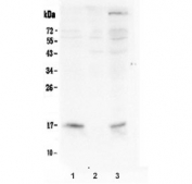 Western blot testing of human 1) COLO-320, 2) SW620 and 3) SGC-7901 lysate with FHIT antibody. Predicted molecular weight ~17 kDa.
