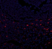Immunofluorescent staining of FFPE human tonsil tissue with CXCL12 antibody (red) and DAPI nuclear stain (blue). HIER: boil tissue sections in pH8 EDTA for 20 min and allow to cool before testing.