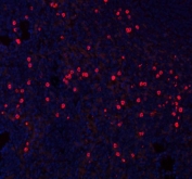 Immunofluorescent staining of FFPE rat spleen tissue with CXCL12 antibody (red) and DAPI nuclear stain (blue). HIER: boil tissue sections in pH8 EDTA for 20 min and allow to cool before testing.