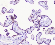 IHC staining of FFPE human placenta with LATS1 antibody at 1ug/ml. HIER: boil tissue sections in pH6, 10mM citrate buffer, for 10-20 min followed by cooling at RT for 20 min.