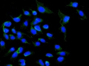 Immunofluorescent staining of FFPE human HeLa cells with NOX5 antibody (green) at 2ug/ml and DAPI nuclear stain (blue). HIER: steam section in pH6 citrate buffer for 20 min.