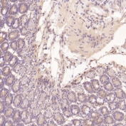 IHC staining of FFPE mouse intestine tissue with EGFR antibody. HIER: boil tissue sections in pH6, 10mM citrate buffer, for 10-20 min and allow to cool before testing.