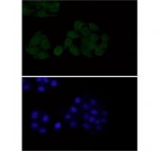 Immunofluorescent staining of FFPE human HeLa cells with EGFR antibody at 1:50 dilution (green) and DAPI nuclear stain (blue). HIER: steam section in pH6 citrate buffer for 20 min.