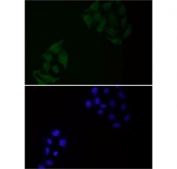 Immunofluorescent staining of FFPE human HeLa cells with EGFR antibody at 1:1500 dilution (green) and DAPI nuclear stain (blue). HIER: steam section in pH6 citrate buffer for 20 min.
