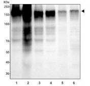 Western blot testing of 1) human HeLa, 2) human A431, 3) human A549, 4) human U-87 MG, 5) rat liver and 6) mouse liver tissue lysate with EGFR antibody. Expected molecular weight: 134-170 kDa depending on glycosylation level.