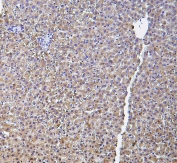 IHC staining of FFPE rat liver with Haptoglobin antibody at 1ug/ml. HIER: boil tissue sections in pH6, 10mM citrate buffer, for 10-20 min and allow to cool before testing.