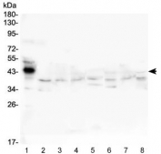 Western blot testing of 1) human placenta, 2) human HepG2 (lot 1), 3) human HepG2 (lot 2), 4) human plasma, 5) rat liver, 6) rat RH35, 7) mouse liver and 8) mouse HEPA1-6 lysate with Haptoglobin antibody at 0.5ug/ml. Predicted molecular weight ~14 kDa (alpha chain), 45-50 kDa (alpha + beta chain).