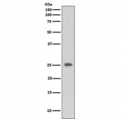 Western blot testing of lysate from human 293 cells treated with Etoposide, with C Reactive Protein antibody. Predicted molecular weight ~26 kDa.