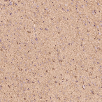 IHC staining of FFPE rat cerebral cortex tissue with S100 beta antibody. HIER: boil tissue sections in pH6, 10mM citrate buffer, for 10-20 min and allow to cool before testing.