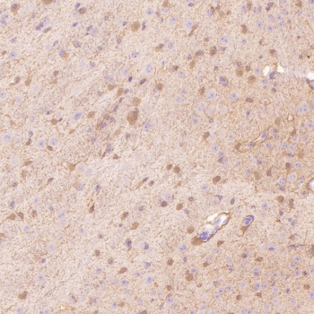 IHC staining of FFPE mouse hippocampus tissue with S100 beta antibody. HIER: boil tissue sections in pH6, 10mM citrate buffer, for 10-20 min and allow to cool before testing.