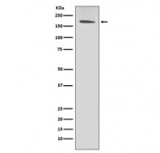 Western blot testing of human SK-BR-3 cell lysate with HER2 antibody.