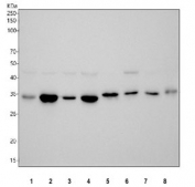 Western blot testing of 1) human HeLa, 2) human Jurkat, 3) human 293T, 4) monkey COS-7, 5) rat thymus, 6) rat PC-12, 7) mouse thymus and 8) mouse SP2/0 cell lysate with Thymidylate Synthase antibody. Predicted molecular weight ~36 kDa.