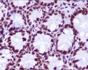 IHC staining of FFPE mouse colon tissue with hydroxyl-Histone H2A antibody (Tyr39). HIER: boil tissue sections in pH6, 10mM citrate buffer, for 10-20 min and allow to cool before testing.