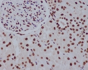 IHC staining of FFPE human kidney tissue with Histone H2A.Z antibody. HIER: boil tissue sections in pH6, 10mM citrate buffer, for 10-20 min and allow to cool before testing.