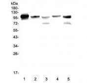 Western blot testing of human 1) placenta, 2) HL60, 3) K562, 4) HepG2 and 5) ThP-1 lysate with Plasminogen antibody. Predicted molecular weight ~92 kDa, may be observed at higher molecular weights due to glycosylation.