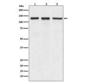 Western blot testing of 1) human A549, 2) mouse spleen and 3) rat brain lyaste with ITGAV antibody. Expected molecular weight: 116-150 kDa.