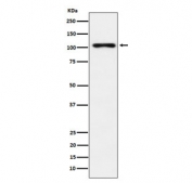 Western blot testing of human thyroid lysate with Thyroid Peroxidase antibody. Predicted molecular weight ~103 kDa but may be observed at higher molecular weights due to glycosylation.