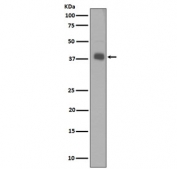 Western blot testing of human SH-SY5Y cell lysate with Synaptophysin antibody. Predicted molecular weight: 34-38 kDa.