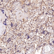 IHC staining of FFPE human placenta tissue with CD45 antibody. HIER: boil tissue sections in pH6, 10mM citrate buffer, for 10-20 min and allow to cool before testing.