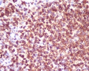 IHC staining of FFPE human spleen tissue with CD45 antibody. HIER: boil tissue sections in pH6, 10mM citrate buffer, for 10-20 min and allow to cool before testing.