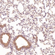 IHC staining of FFPE mouse lung tissue with CD45 antibody. HIER: boil tissue sections in pH6, 10mM citrate buffer, for 10-20 min and allow to cool before testing.